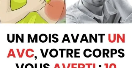Un mois avant un avc votre corps vous previent 10 signes a ne pas ignorer.jpg