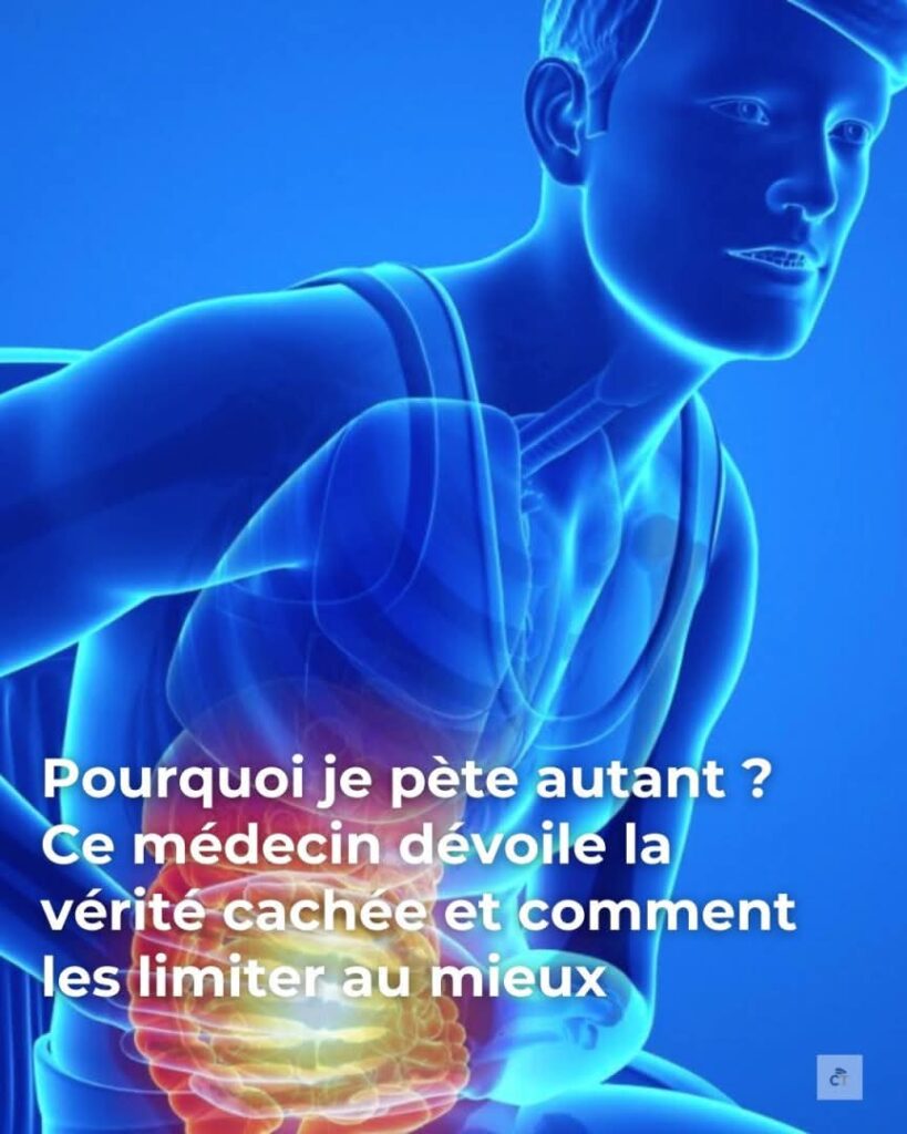 9a1281f2 58ae 483a a58d 1b9965617f49 1 819x1024