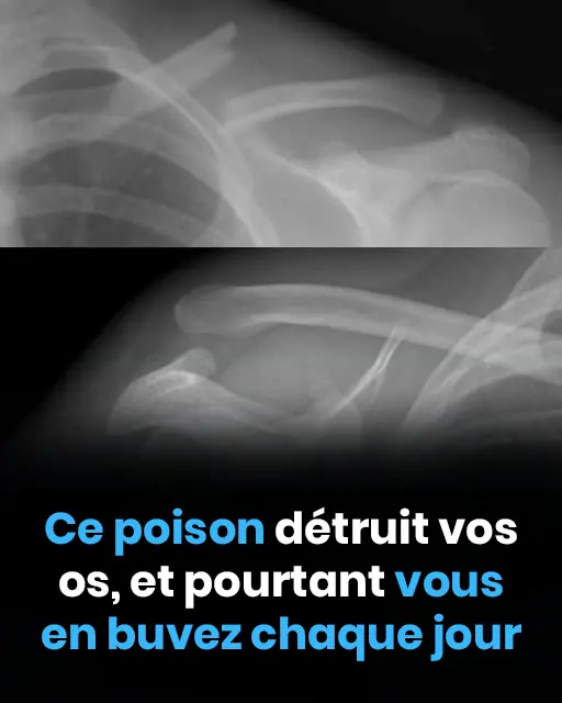 Cette boisson abime vos os de linterieur et pourtant tout le monde la consomme.jpg