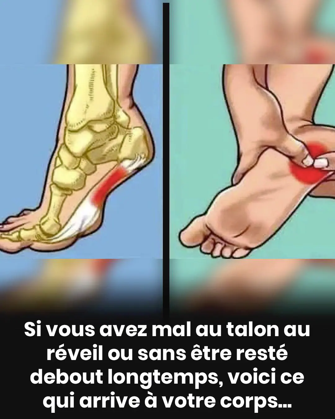 Douleur au talon les causes les plus courantes et le role de la fasciite plantaire.jpg