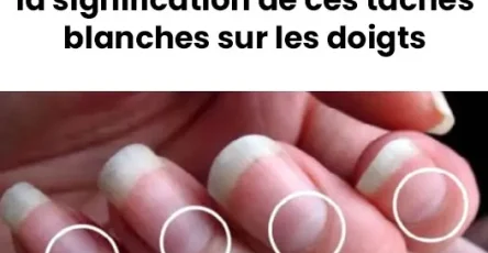 Que signifie les taches blanches sur les ongles.jpg