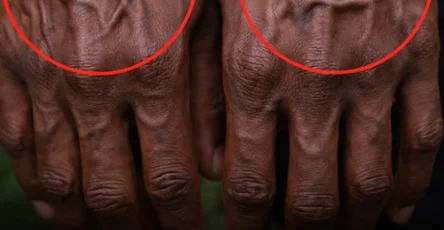 Si vos veines sont visibles en voici la signification 2.jpg