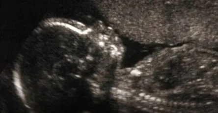 Et si lautisme laissait une trace invisible des la naissance 819x1024.jpg