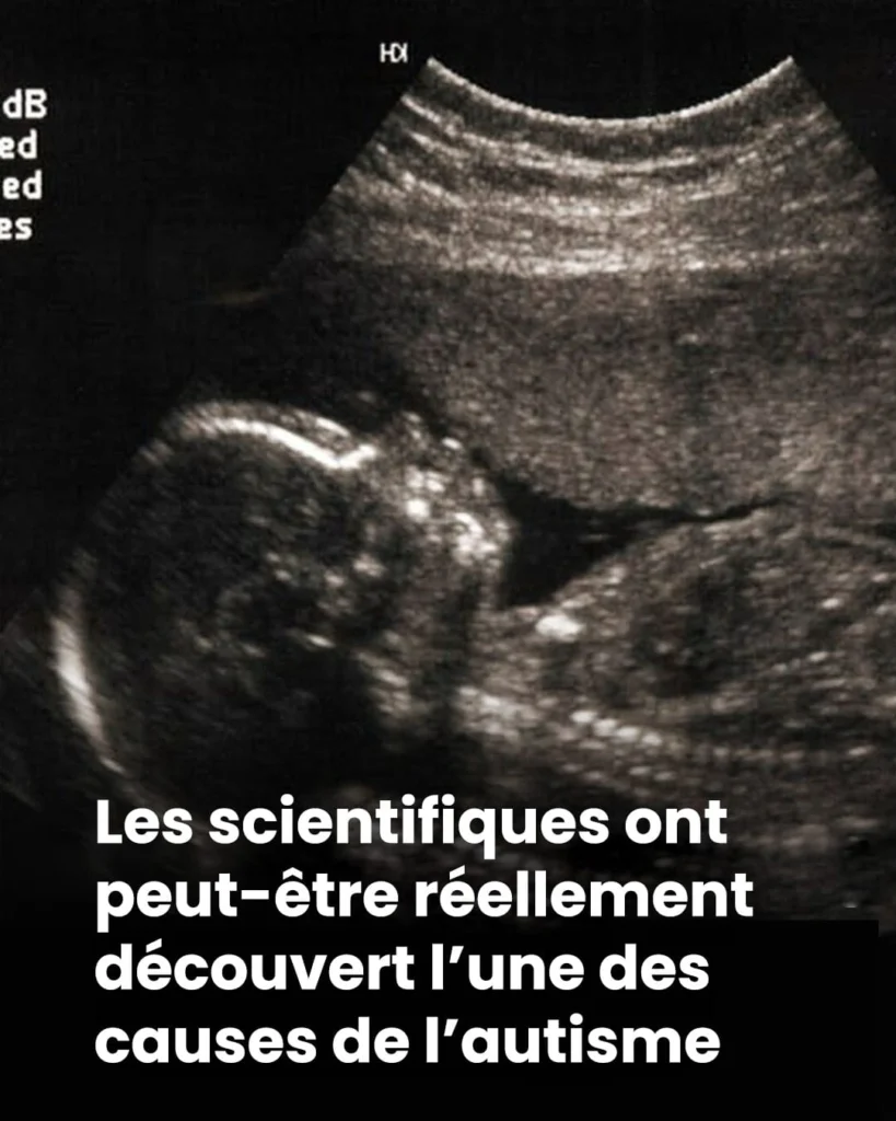 Et si lautisme laissait une trace invisible des la naissance 819x1024.jpg