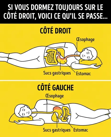 Quels sont les risques encourus lorsquon dort sur le cote droit.jpg