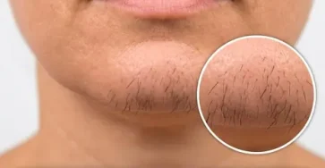 Si vous etes une femme avec des poils au menton voici ce que cela signifie vraiment.jpg