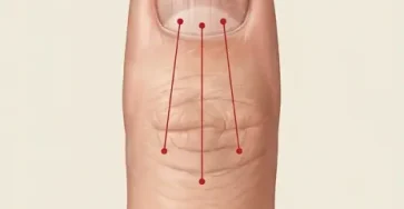 Si vous remarquez des stries sur vos ongles cela pourrait indiquer que vous souffrez de ceci.jpg