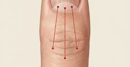 Si vous remarquez des stries sur vos ongles cela pourrait indiquer que vous souffrez de ceci.jpg